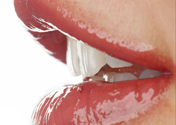 セラミック審美治療