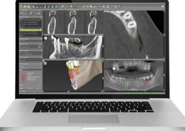 骨の状態まで診るカウンセリング