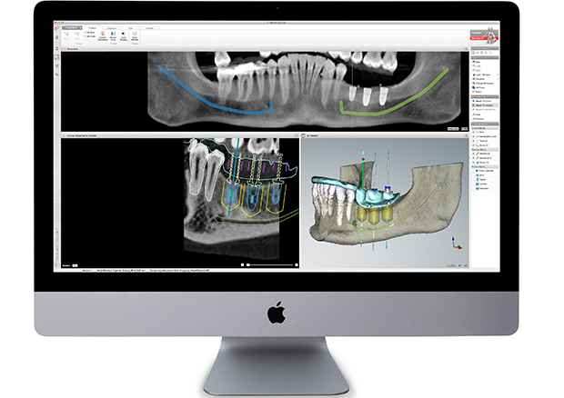 3Dコンピュータシミュレーション