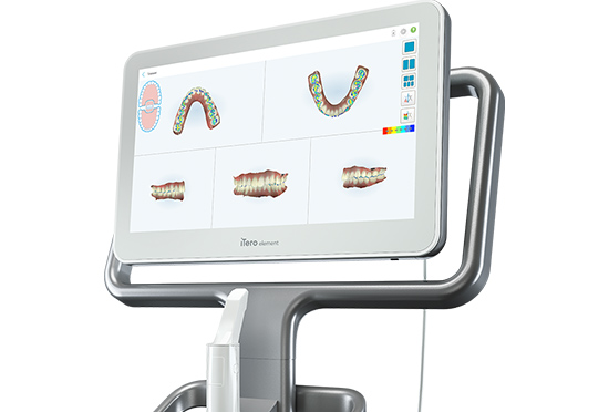 口腔内スキャナー_iTero