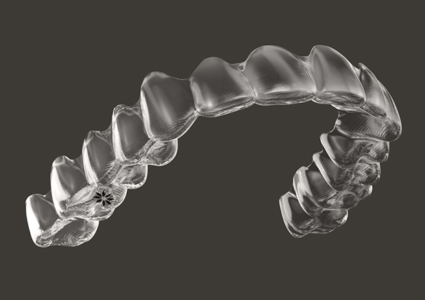 マウスピース矯正とは