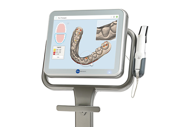 iTeroスキャニングとは